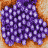 Norovirus Virions (Photo Credit: Charles D. Humphrey)